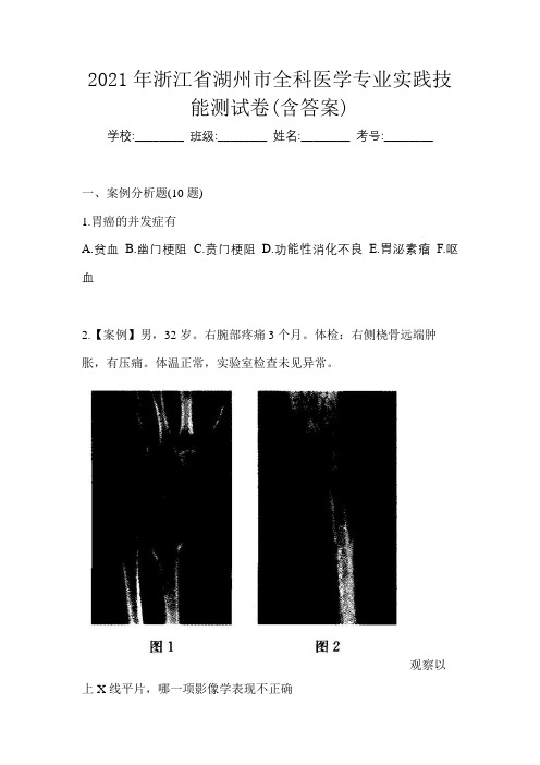 2021年浙江省湖州市全科医学专业实践技能测试卷(含答案)