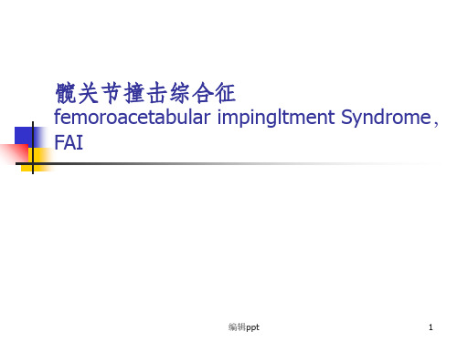 髋关节撞击综合征的影像学诊断