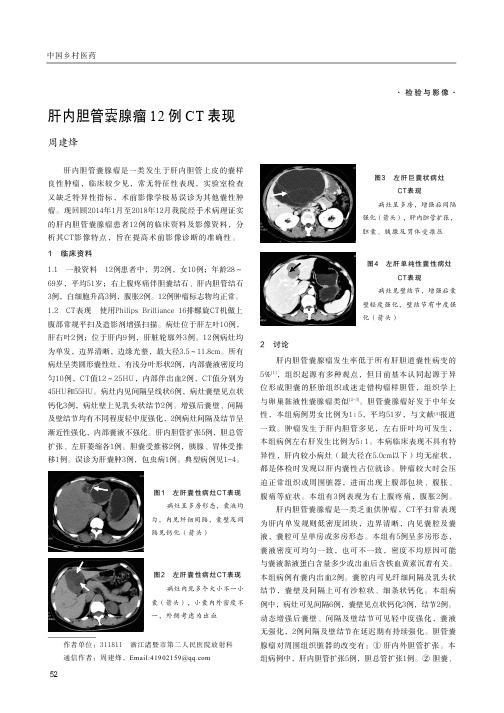 肝内胆管囊腺瘤12例ct表现