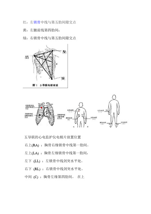 心电监护仪电极片放置部位