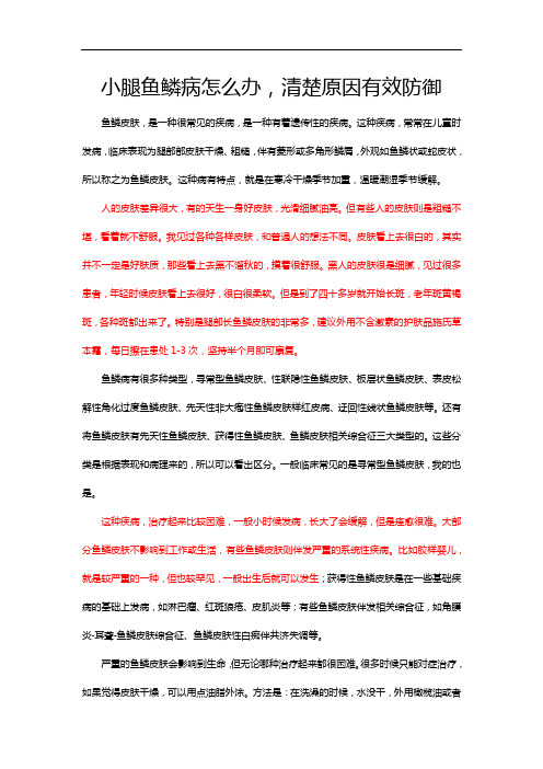 小腿鱼鳞病怎么办 ,清楚原因有效防御