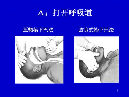 心肺复苏(有图)
