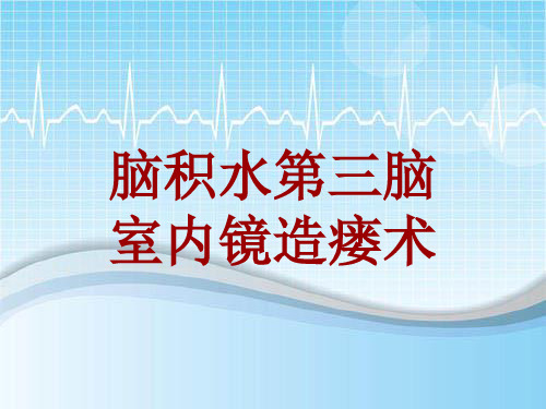 手术讲解模板：脑积水第三脑室内镜造瘘术