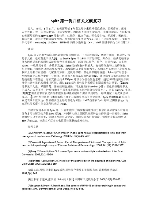 Spitz痣一例并相关文献复习