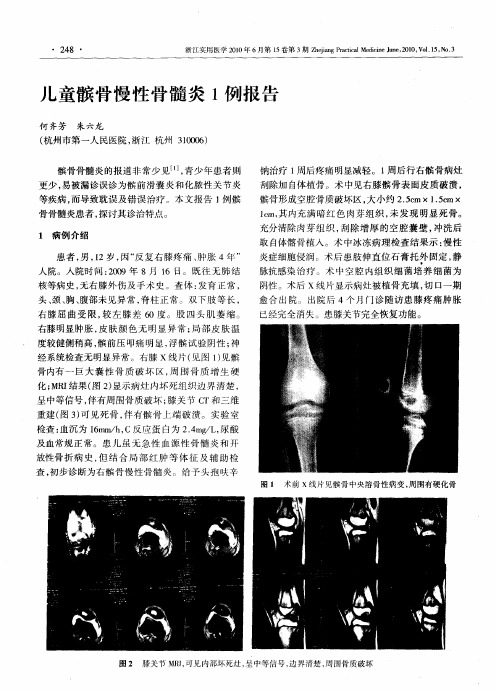 儿童髌骨慢性骨髓炎1例报告