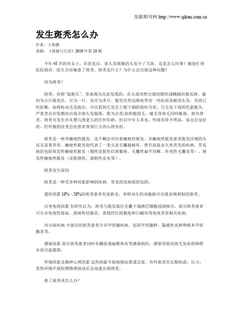 发生斑秃怎么办