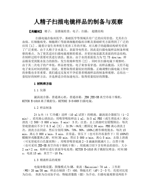 人精子扫描电镜样品的制备与观察