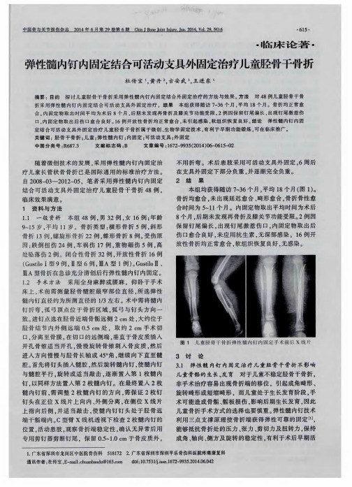 弹性髓内钉内固定结合可活动支具外固定治疗儿童胫骨干骨折
