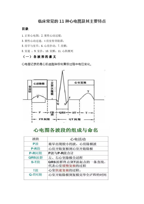 临床常见的11种心电图及其主要特点