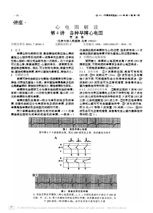 心电图解读第4讲各种早搏心电图