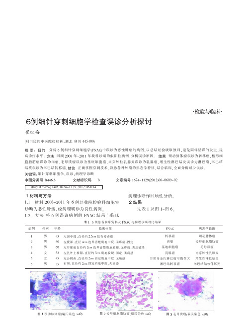 6例细针穿刺细胞学检查误诊分析探讨