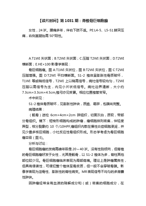【读片时间】第1031期：脊椎骨巨细胞瘤