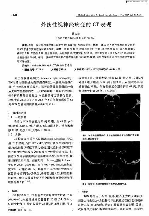 外伤性视神经病变的CT表现