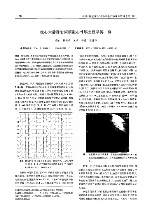 经心大静脉射频消融心外膜室性早搏一例