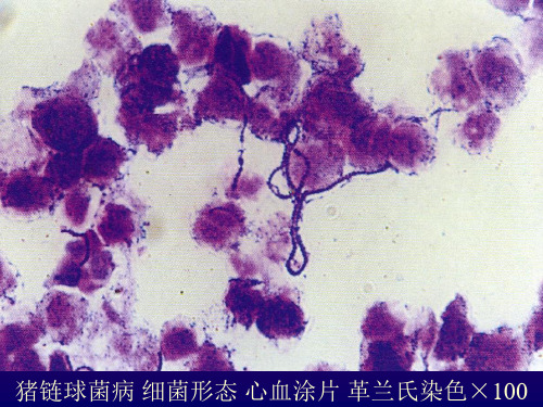 23 猪链球菌病