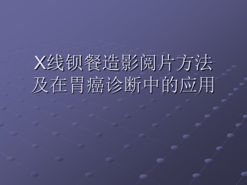 x线钡餐造影阅片方法及在胃癌诊断中的应用