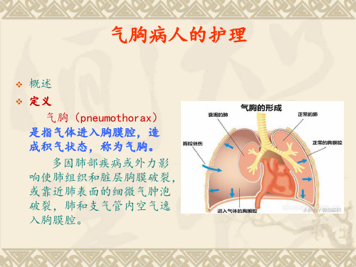 气胸病人的护理PPT课件