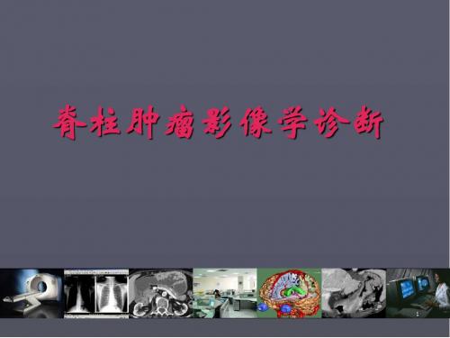 (医学课件)脊柱肿瘤影像学诊断医学影像