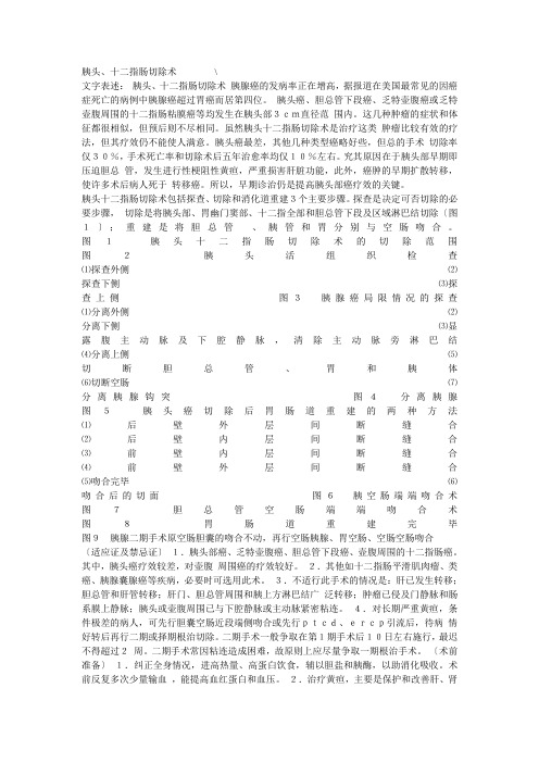 whipple手术