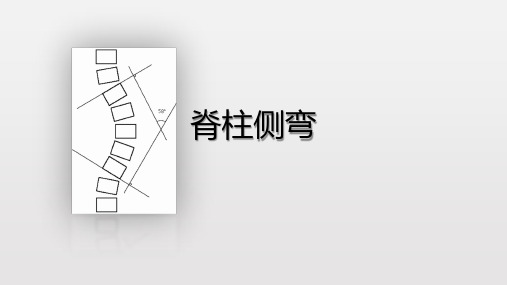 脊柱侧弯康复