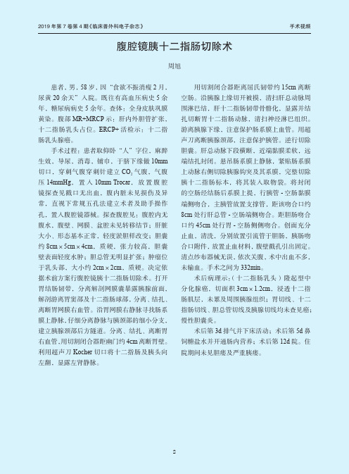 腹腔镜胰十二指肠切除术