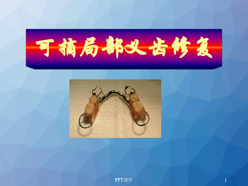可摘局部义齿修复  ppt课件