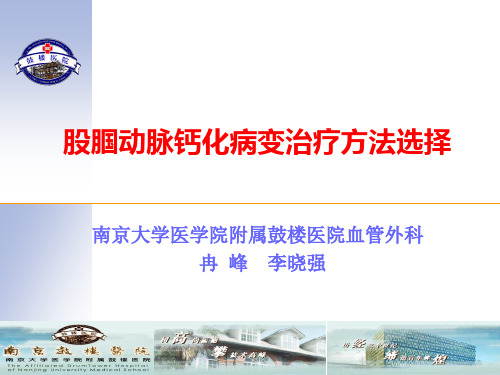 股腘动脉钙化病变治疗方法选择