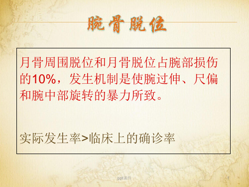 关于腕骨脱位  ppt课件