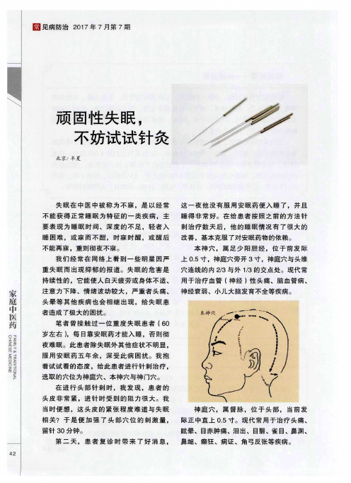 顽固性失眠,不妨试试针灸