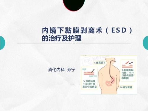 ESD患者的治疗及护理