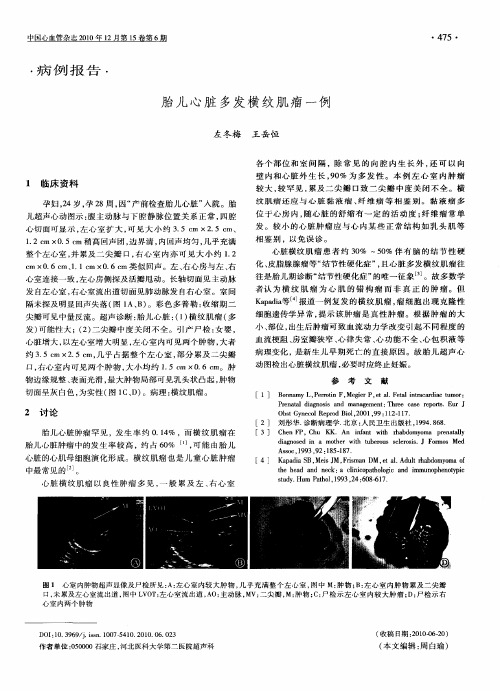 胎儿心脏多发横纹肌瘤一例