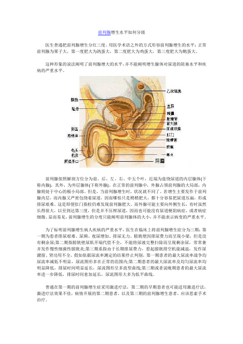 前列腺增生水平如何分级(精)