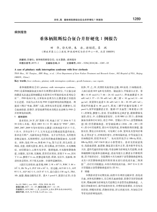 垂体柄阻断综合征合并肝硬化1例报告