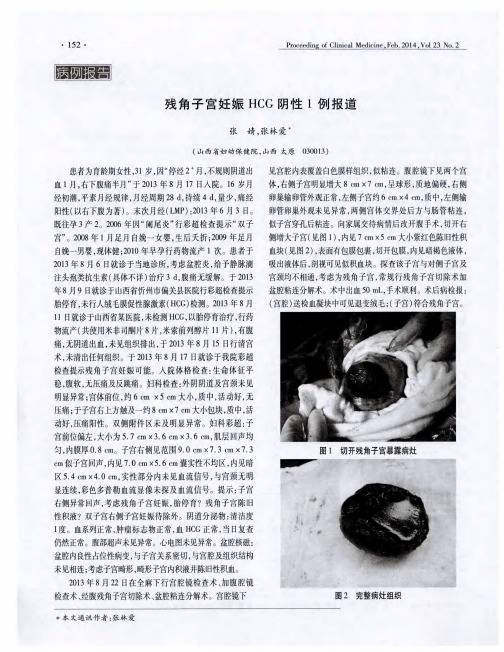 残角子宫妊娠HCG阴性1例报道