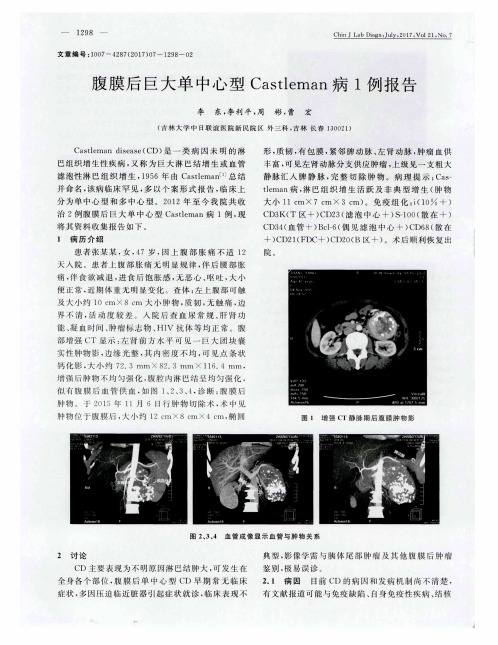 腹膜后巨大单中心型Castleman病1例报告