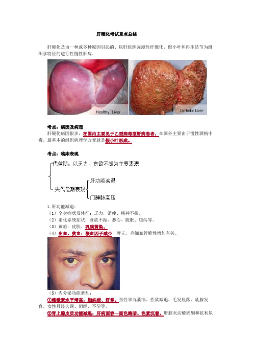 肝硬化考试重点总结