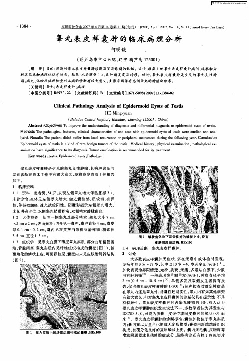 睾丸表皮样囊肿的临床病理分析