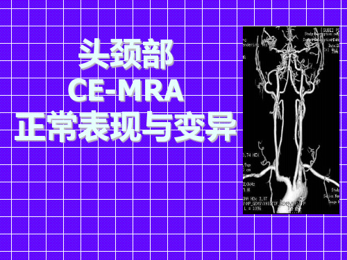 头颈部CE-MRA正常表现与变异