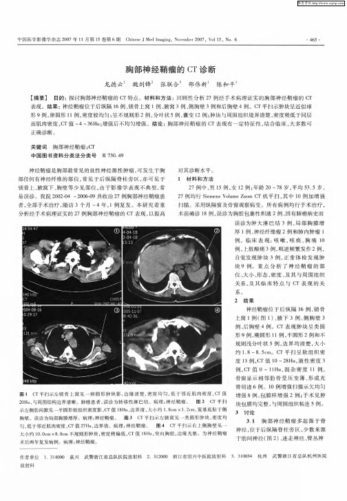 胸部神经鞘瘤的CT诊断