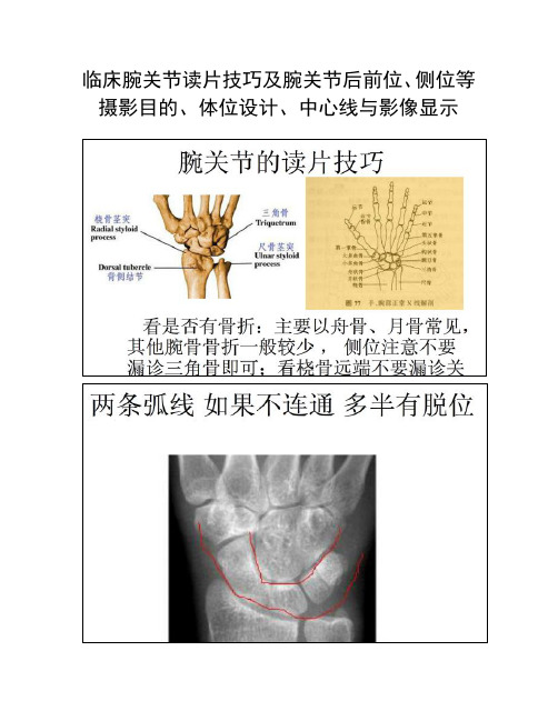 临床腕关节读片技巧及腕关节后前位、侧位等摄影目的、体位设计、中心线与影像显示