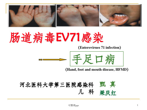 《EV71感染培训》PPT课件