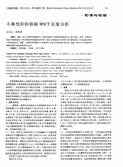 不典型肝转移癌MSCT征象分析