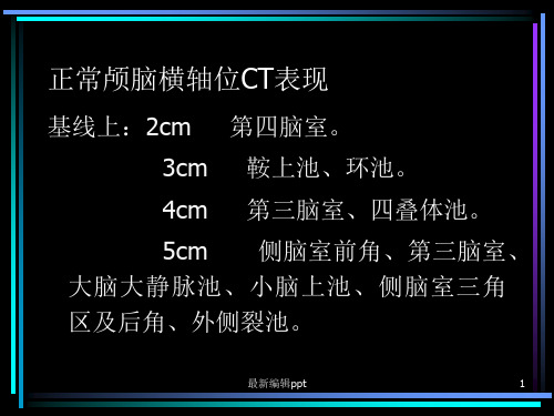 头颅CT解剖ppt课件