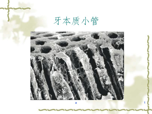牙本质封闭