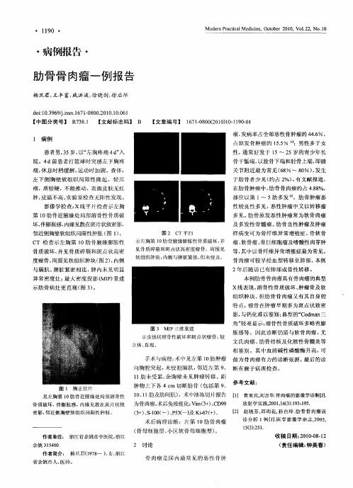 肋骨骨肉瘤一例报告