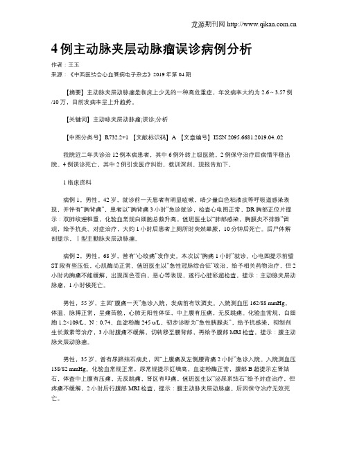 4例主动脉夹层动脉瘤误诊病例分析