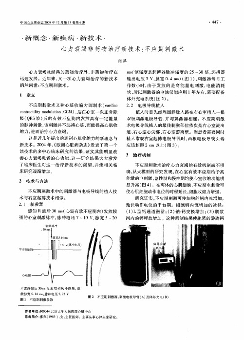 心力衰竭非药物治疗新技术：不应期刺激术