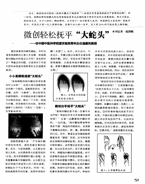 微创轻松抚平“大蛇头”——访中国中医科学院望京医院骨科主任温建民教授