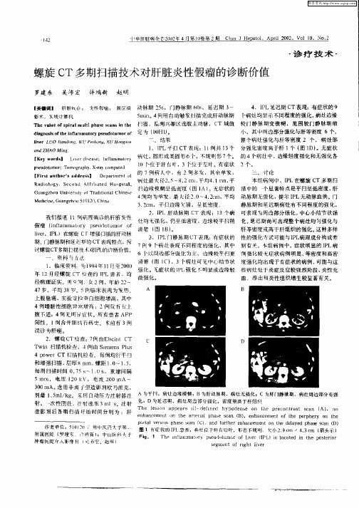 螺旋CT多期扫描技术对肝脏炎性假瘤的诊断价值