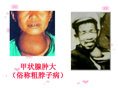 人教版九年级化学第十二单元课题2《化学元素与人体健康》PPT课件(共36张PPT)